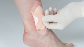 Picture of a bandage on an ankle