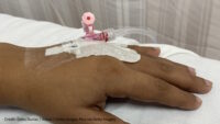 Picture of a hand with IV